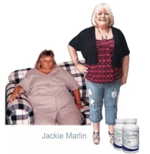 Jackie Marlin Before and After